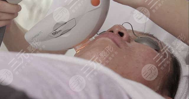 果酸祛痘做几次见