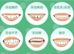 正畸牙齿的年龄限制是多大岁数？矫正不盲目，先来看科普！