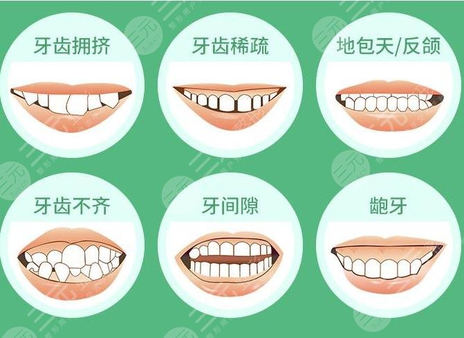 牙齿矫正年龄阶段