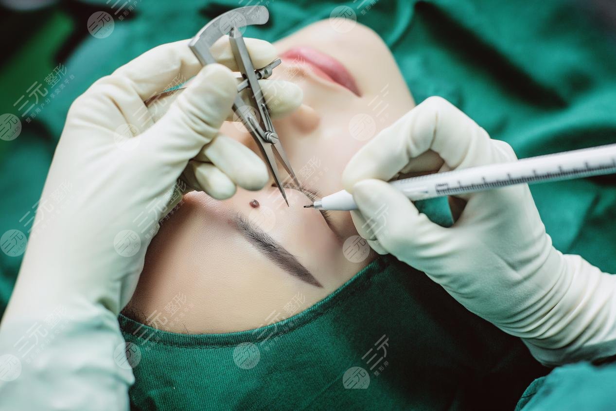 汪立川双眼皮怎么样