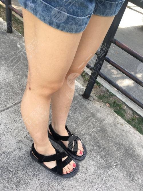 腰腹环吸水动力