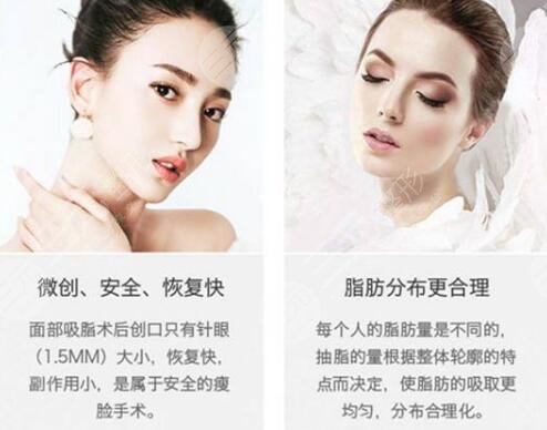面部光纤溶脂优点