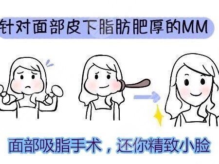 面部吸脂