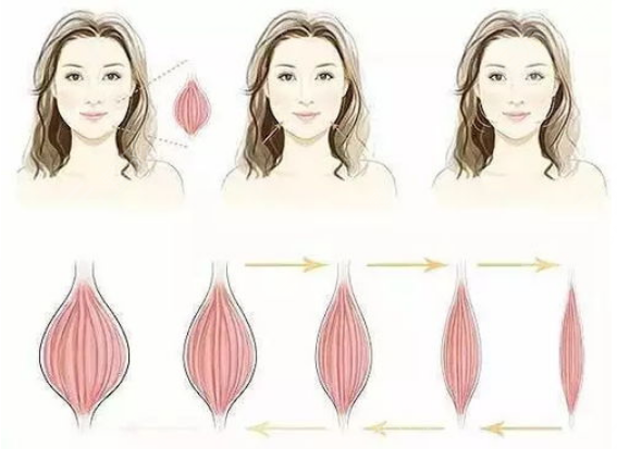 注射瘦脸是打50还是100剂量？每个人面部情况不一样，可别在稀里糊涂啦！