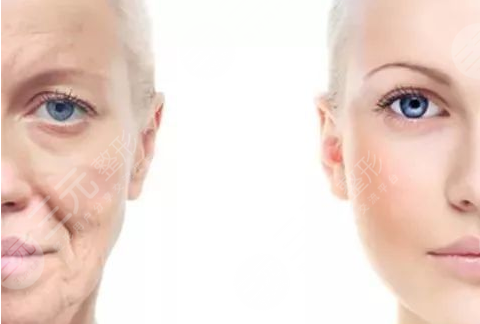 恩喜整形医院细胞重组安多果盘点【真人图】