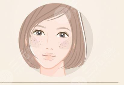 激光祛黄褐斑反多久可以恢复