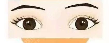 眼睑吸脂前后对比