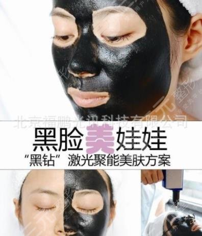 黑脸娃娃嫩肤术前注意什么