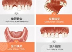 种植牙有什么风险和后遗症？看了你还敢种植吗？
