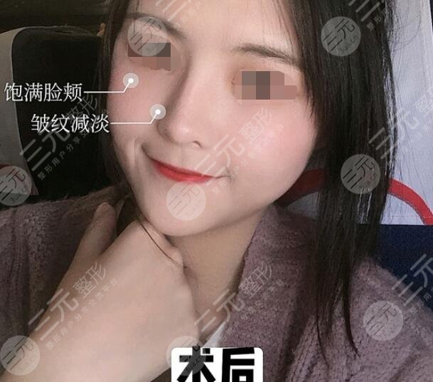 徐怀河医生真人案例参考后