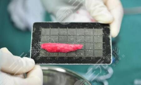 隆鼻手术危险吗