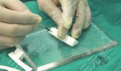隆鼻手术风险