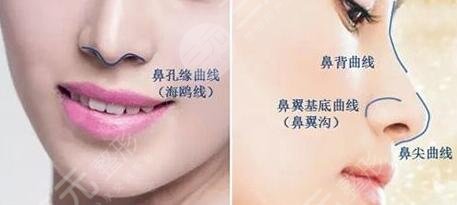 什么是隆鼻手术