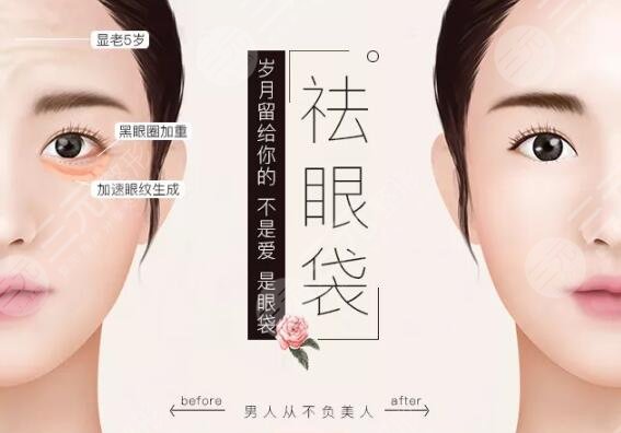 眼袋切除术后注意事项