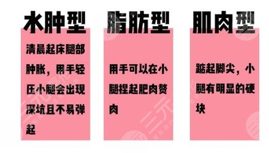韩辰注射瘦腿价格怎样