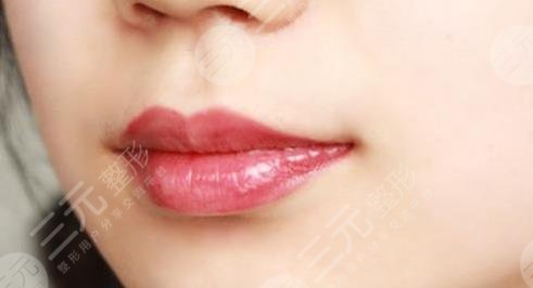 胶原蛋白丰唇果