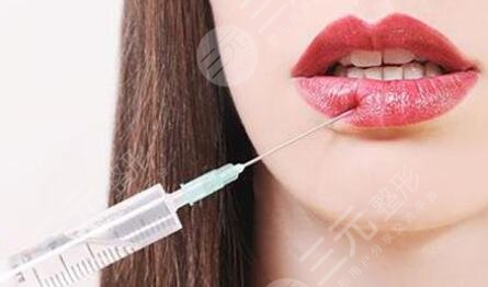 丰唇手术前需要注意的事项
