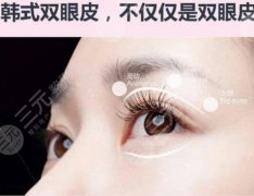 韩式微创双眼皮可以保持多少年？韩式微创双眼皮的优势