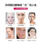 彩光去雀斑的注意事项你都了解了吗?想白净无暇, 先做好功课! 彩光去雀斑的注意事项你都了解了吗?想白净无暇, 先做好功课!