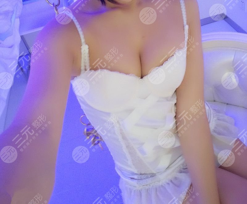 乳房缩小术前后对比,看了你就相信杭州美来比较好!