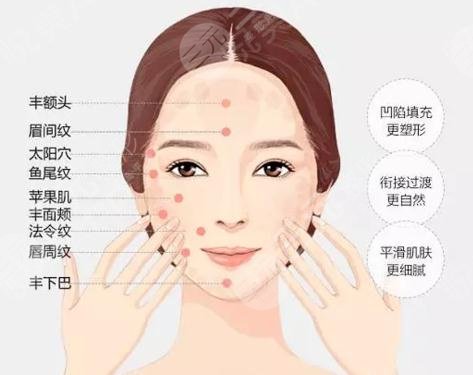 面部填充整容价格多少钱价格果图分享干瘪面容重焕生机