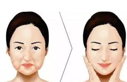什么是面部填充整容