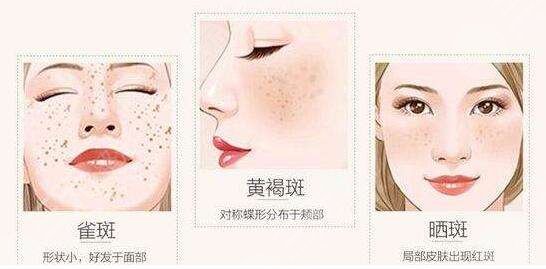 彩光去雀斑的注意事项