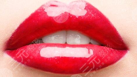 胶原蛋白丰唇果怎么样？注意事项具体有哪些？