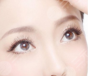 开眼角多久可以重新修复，带你详细了解开眼角手术