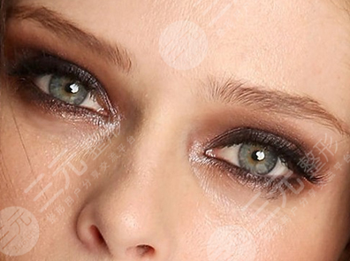 开眼角多久可以重新修复，带你详细了解开眼角手术