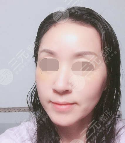 面部年轻化plus全脸，快速解决面部问题，内附真实案例分享图