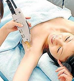 腋下激光脱毛的价格