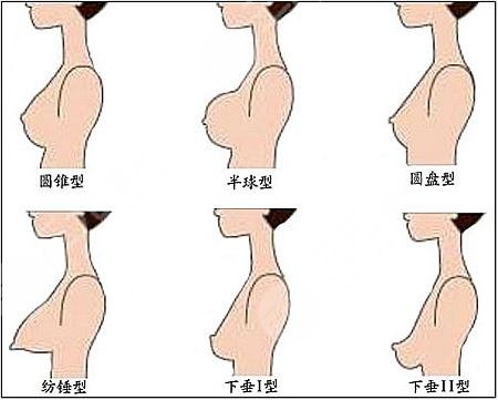 胸部下垂整形的费用是多少?什么方法好?美胸的秘密为你揭晓! 胸部下垂整形的费用是多少?什么方法好?美胸的秘密为你揭晓!