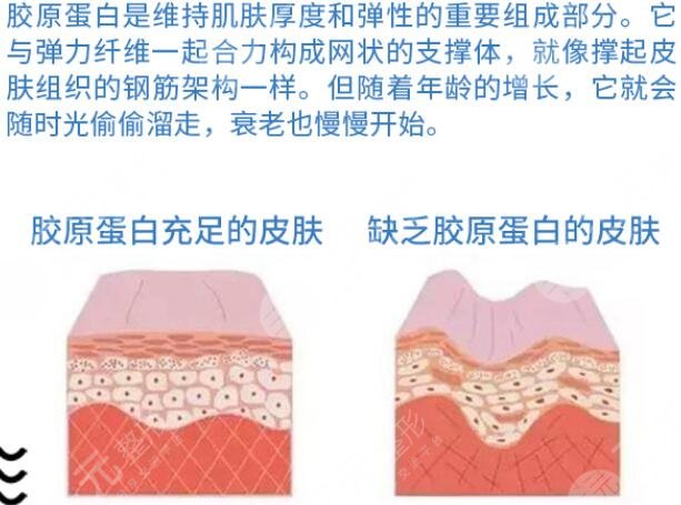注射,胶原蛋白,隆鼻,价格,