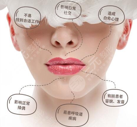 缓解兔唇多少钱？分享参考价格，值得花费金钱！