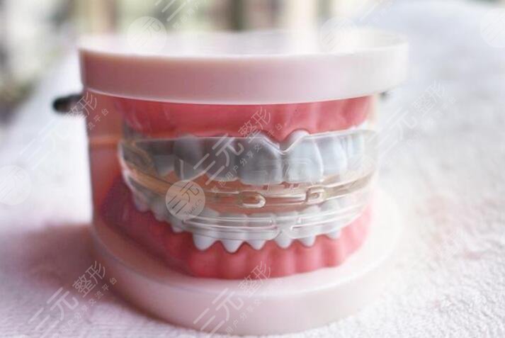 t4a牙齿矫正器