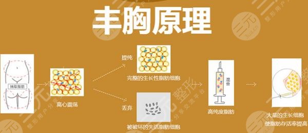 自体脂肪丰胸的风险有哪些