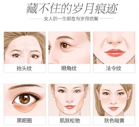 热玛吉