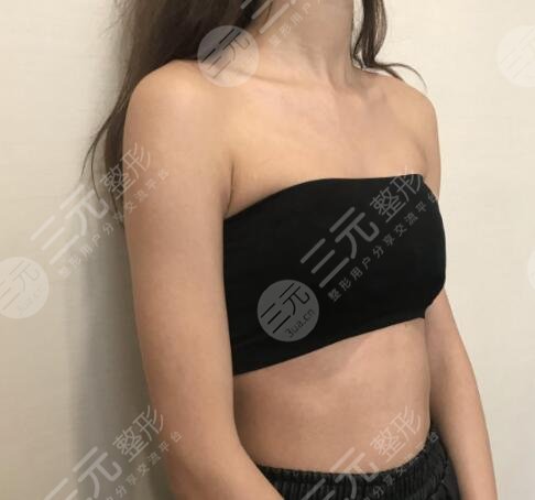 四川华西医院整形外科怎么样?让你拥有性感胸部!