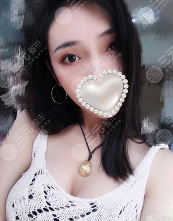 广州禾丽医疗美容医院怎么样?价目表及丰胸真人show