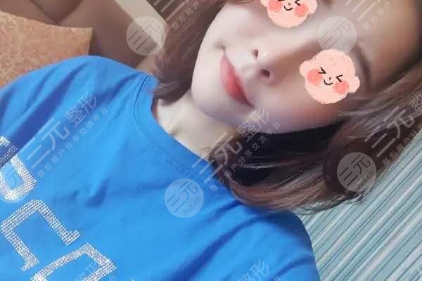 上海九院隆鼻价目表2020大公开,还有漂亮的隆鼻果分享哦!
