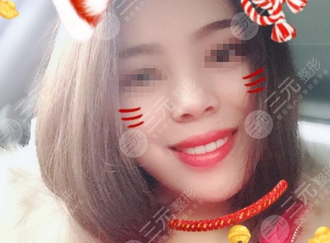 荆门雅泰口腔半隐形陶瓷矫正分享