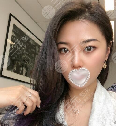 热玛吉前后对比果图,爱美人士都会震惊热玛吉的果是多么神奇和率高