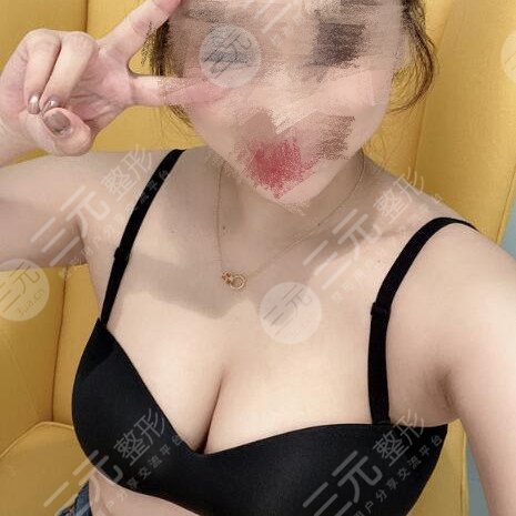 上海九院隆胸哪个医生比较好？大家想要的丰满身材已不再是梦想了