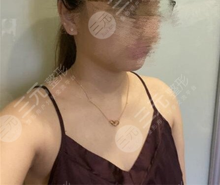 上海九院隆胸哪个医生比较好？大家想要的丰满身材已不再是梦想了