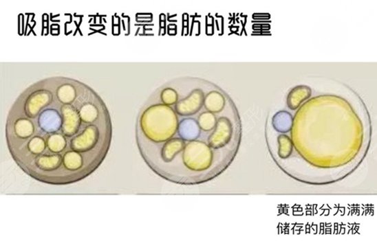 做抽脂整形一般价格