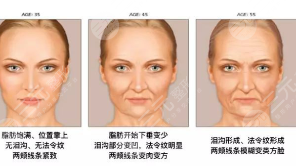 有法令纹怎么办？以下几种方法希望可以帮助大家缓解法令纹带来的苦恼