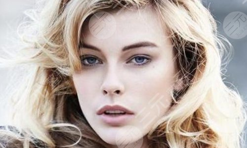 开个眼角需要多少钱