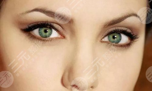 开个眼角需要多少钱