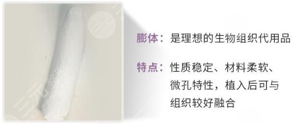 膨体隆鼻